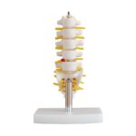 Lumbar Vertebra (Sakrum Koksiks ve Fıtıklı) Modeli Küçük Boy
