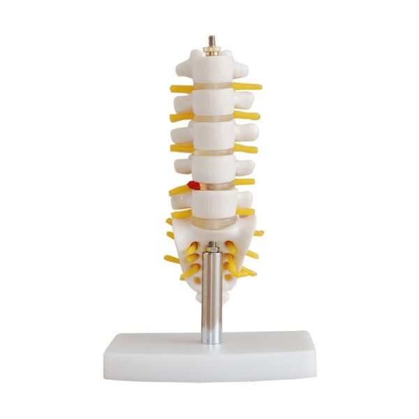 Lumbar Vertebra (Sakrum Koksiks ve Fıtıklı) Modeli Küçük Boy