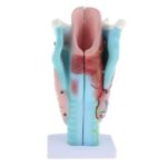Gırtlak (Larenks) Modeli 3 Parça - Görsel 3